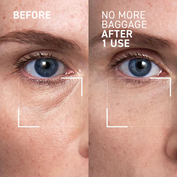 No More Baggage Eye Bag Cream-Depuff, Tighten & Brighten Tired Under-Eyes in Just 5 Minutes