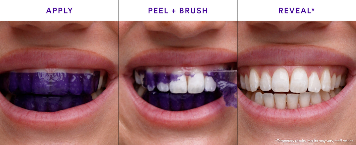 Glowfiltr V34 Whitening Strips, Teeth Whitening Strips, Tooth Stain Treatment, Combining Whitening and Colour Correction