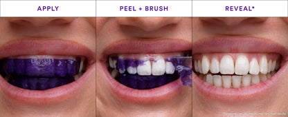 Glowfiltr V34 Whitening Strips, Teeth Whitening Strips, Tooth Stain Treatment, Combining Whitening and Colour Correction