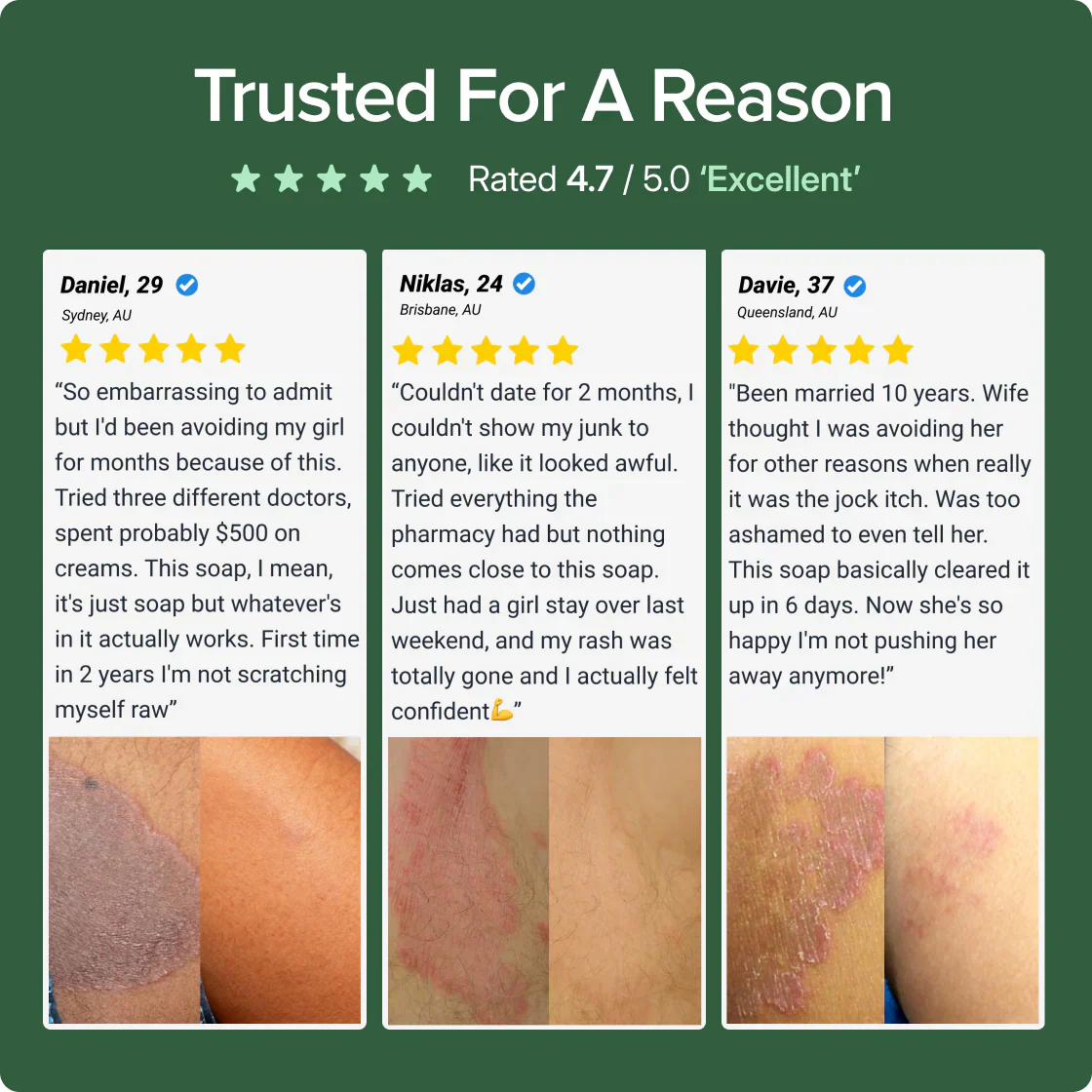 Veloma Antifungal Soap