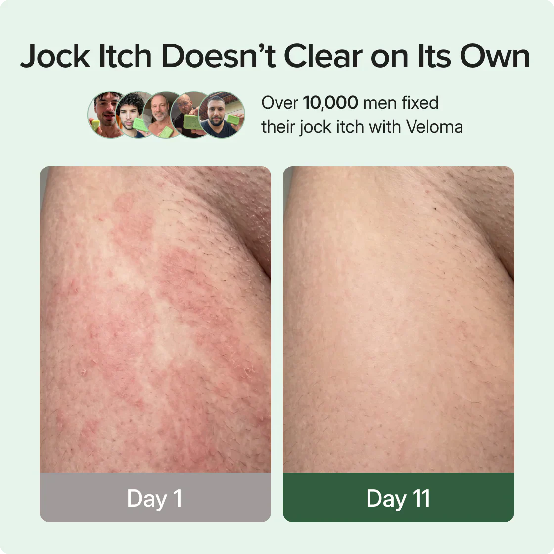 Veloma Antifungal Soap